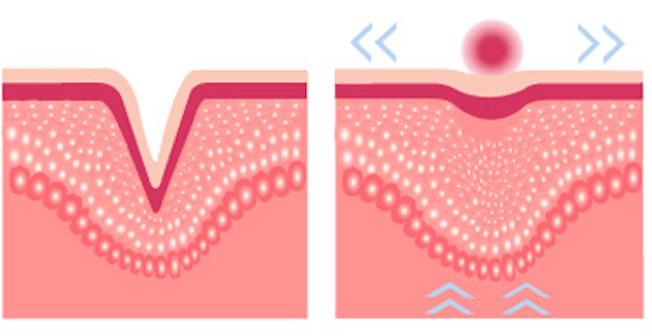 Beauty Angel Lys effekt